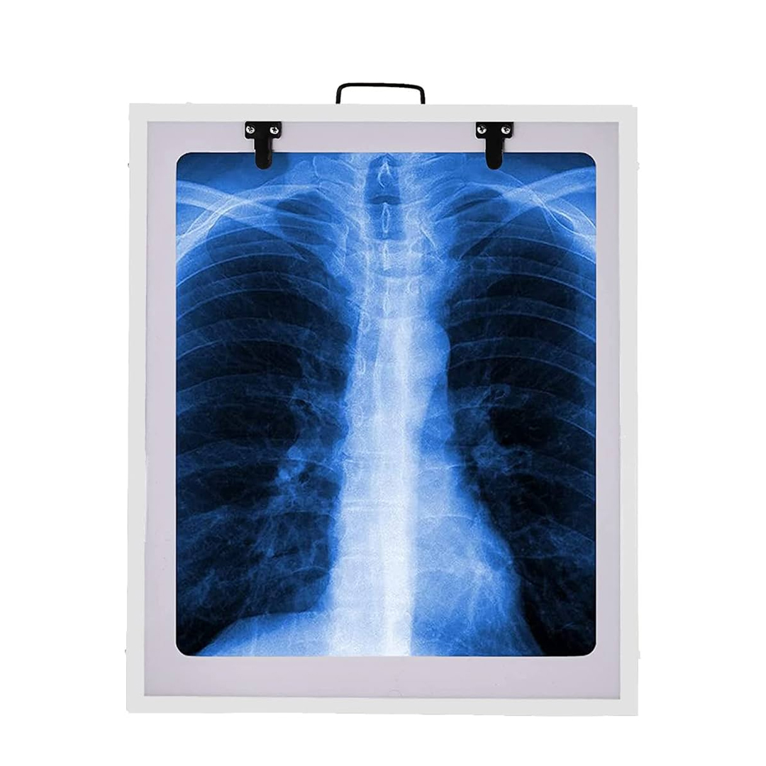 X-Ray Viewer available in online  pharmacy qatar, doha 